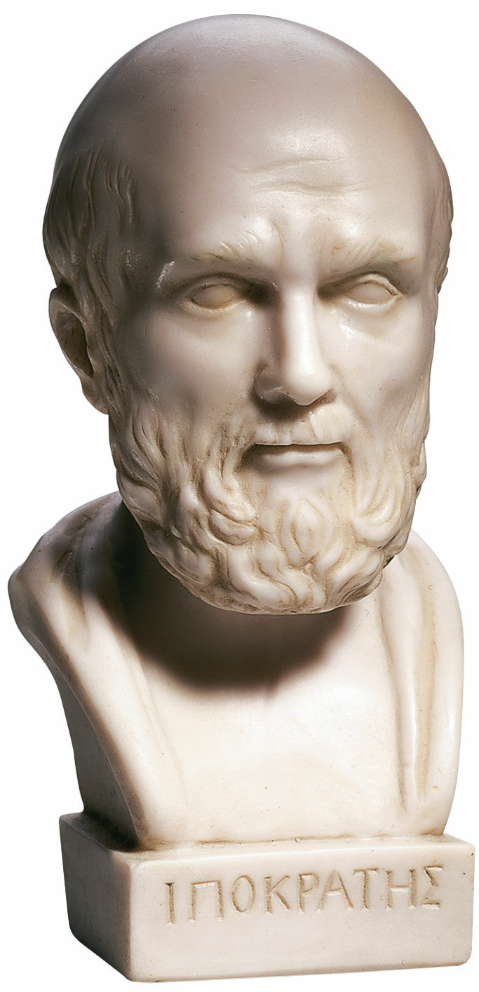 Buste van Hippocrates, gegoten
